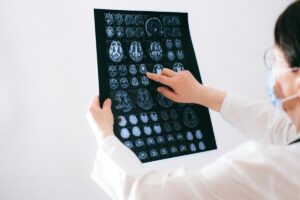 Depo-Provera meningioma lawsuit women