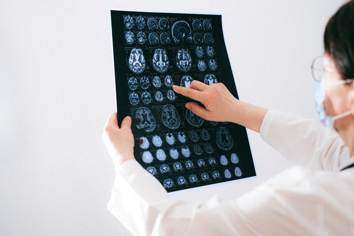 Depo-Provera meningioma lawsuit women