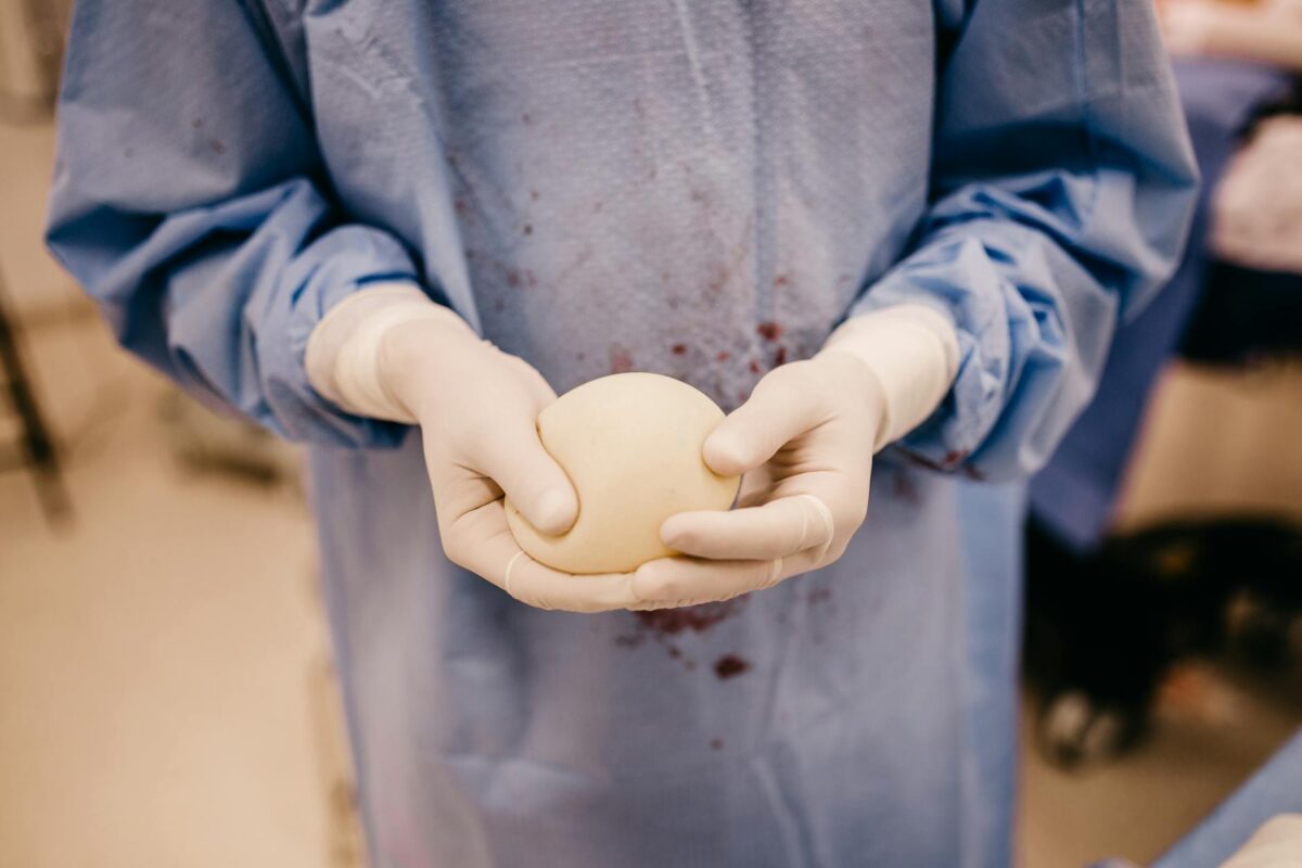 Allergan Biocell Textured Breast Implant Products Liability lawsuit