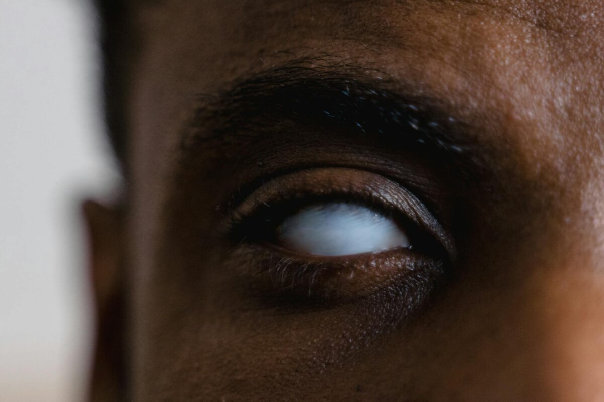 Ozempic vision loss NAION lawsuit