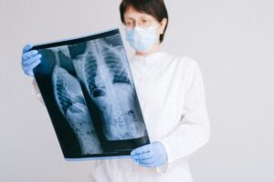 Bard PowerPort catheter fracture
